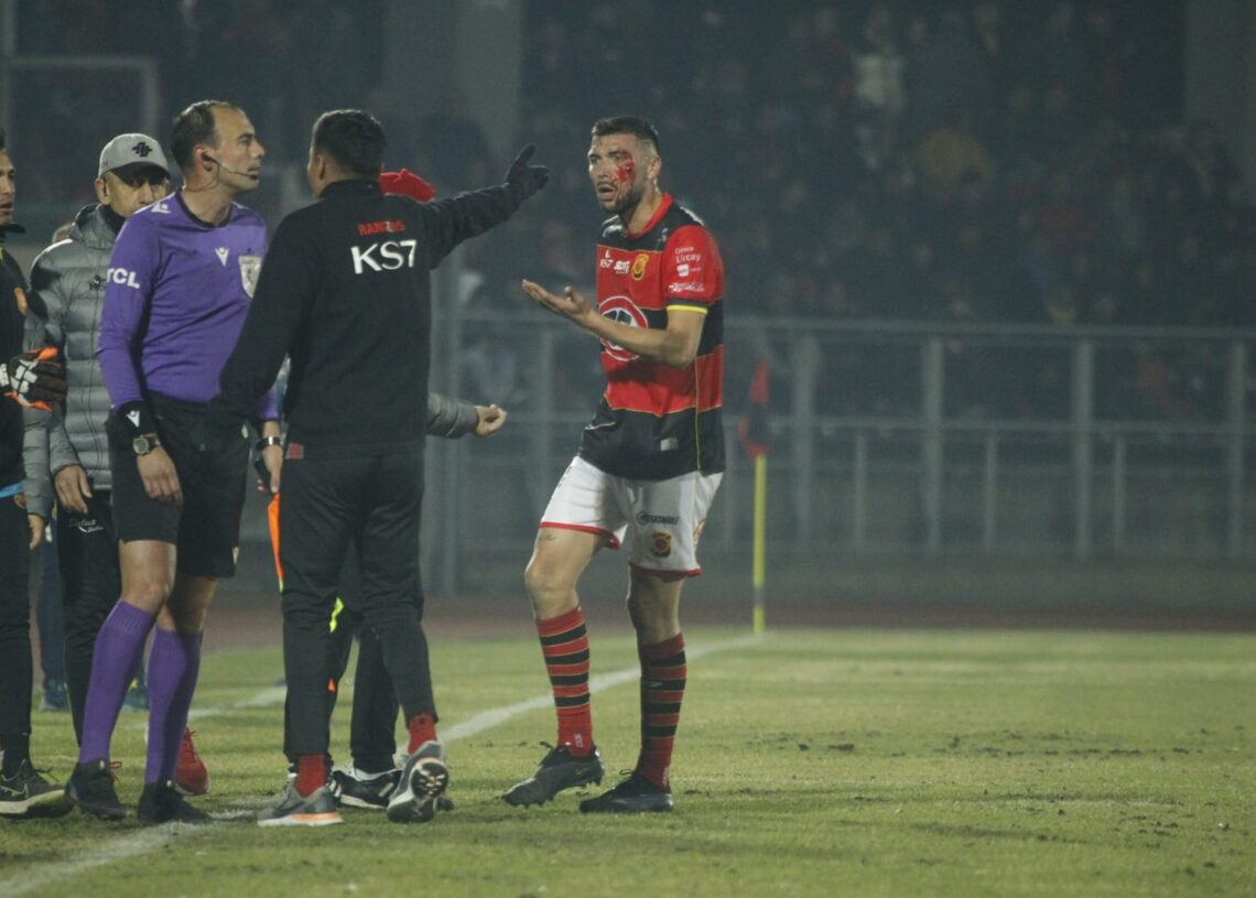 [IMÁGENES] Así quedó jugador de Rangers que recibió brutal agresión no sancionada y terminó en gol